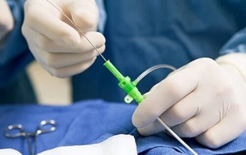 estudio-electrofisiologia-que-es-para-que-sirve Estudios electrofisiológicos