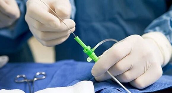 estudio-electrofisiologia-que-es-para-que-sirve Estudios electrofisiológicos