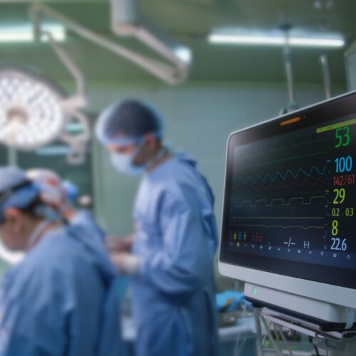 Heart rate and patient control monitor in hospital theater room during surgery operation Válvulas cardíacas