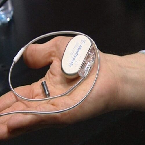 marcapaso Marcapasos convencionales