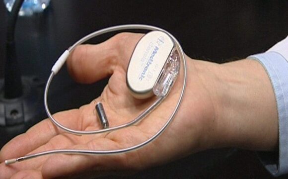 marcapaso Marcapasos convencionales