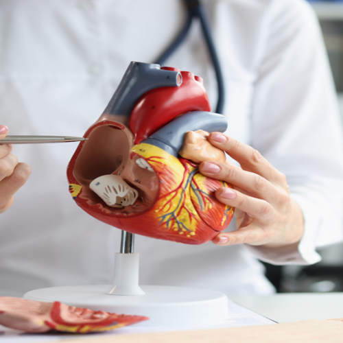 Bloqueo atrioventricular El bloqueo atrioventricular