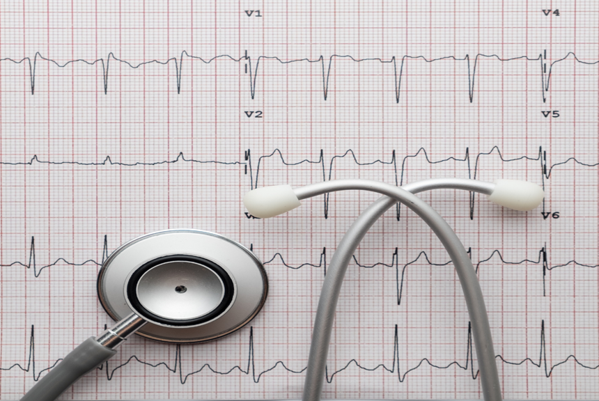 Síntomas bloque atrioventricular Síntomas del bloqueo atrioventricular