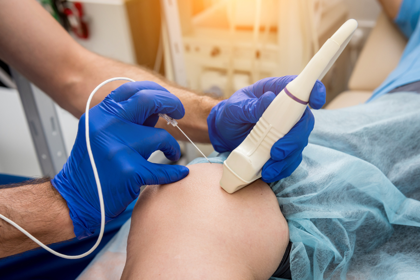 _Ablación por radiofrecuencia Ablación por radiofrecuencia